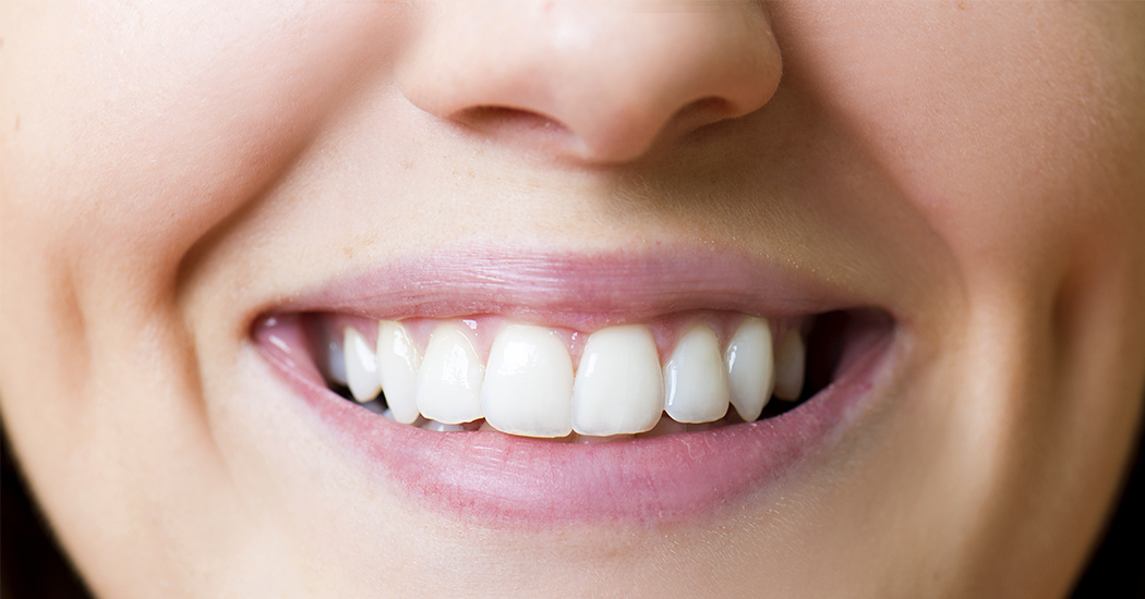 Le verdict beauté: Smile Detox, la cure naturelle de blanchiment des dents