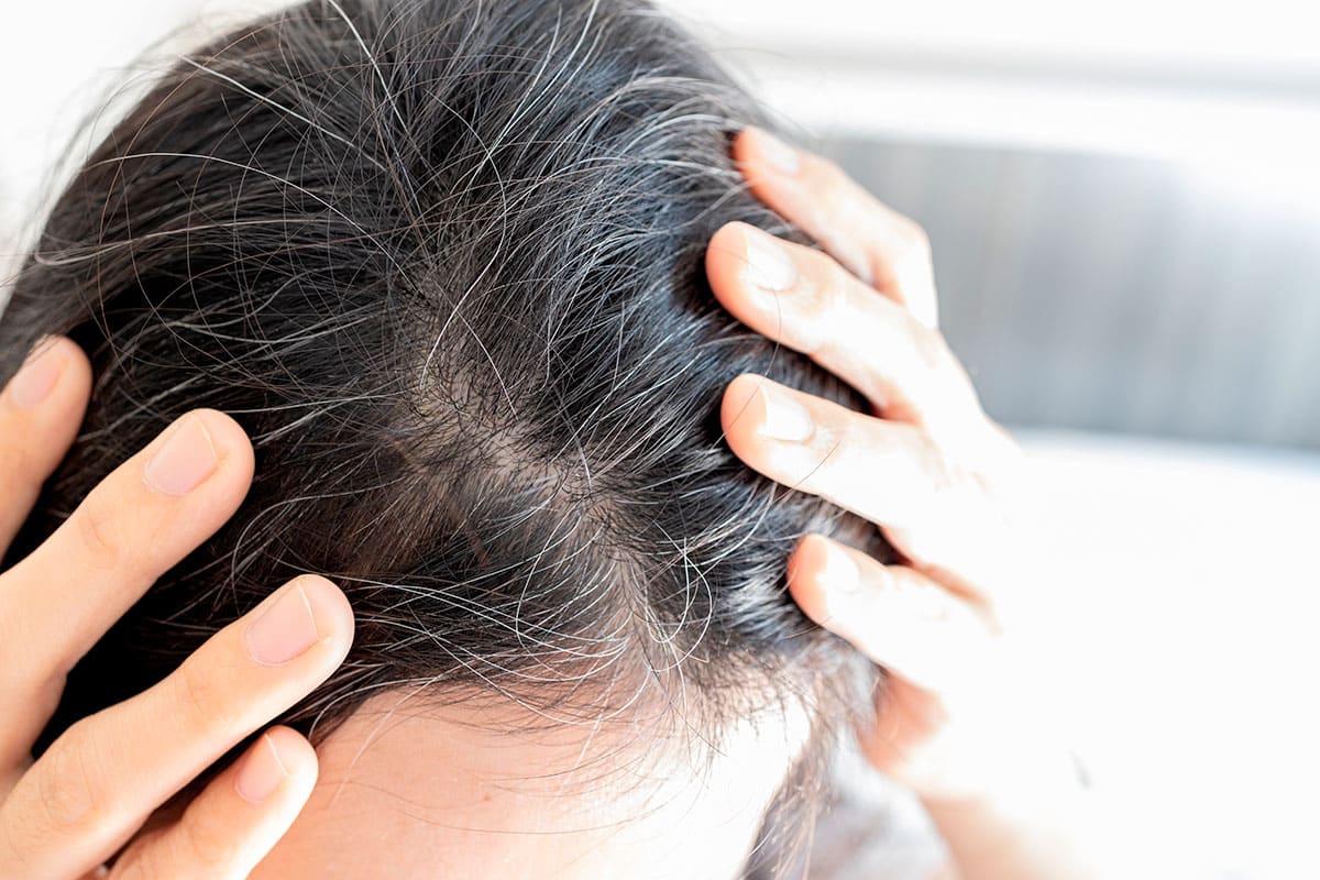 Deze dermatoloog raadt deze 3 gewoonten aan om het verschijnen van grijze haren uit te stellen